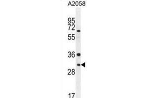 Image no. 2 for anti-ARV1 Homolog (ARV1) antibody (ABIN2995757)