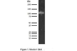 Image no. 1 for anti-ADAM Metallopeptidase with Thrombospondin Type 1 Motif, 13 (ADAMTS13) antibody (Biotin) (ABIN5566848)