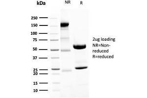 Image no. 4 for anti-Neurofilament, Heavy Polypeptide (NEFH) antibody (ABIN6940186)