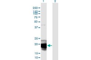 Image no. 3 for anti-Interleukin 23, alpha subunit p19 (IL23A) (AA 1-189) antibody (ABIN2565633)
