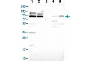 Image no. 2 for anti-Protein Phosphatase 1, Regulatory Subunit 37 (PPP1R37) antibody (ABIN5582756)