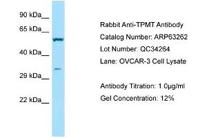 Image no. 1 for anti-Thiopurine S-Methyltransferase (TPMT) (C-Term) antibody (ABIN2789428)