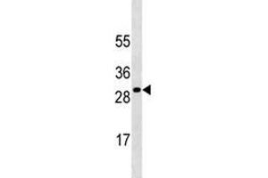Image no. 2 for anti-Suppressor of Cytokine Signaling 3 (SOCS3) antibody (ABIN3029045)