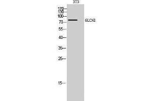 Image no. 1 for anti-Glucosamine (UDP-N-Acetyl)-2-Epimerase/N-Acetylmannosamine Kinase (GNE) (C-Term) antibody (ABIN3184799)
