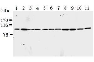 Image no. 1 for anti-Karyopherin (Importin) beta 1 (KPNB1) antibody (ABIN1449199)