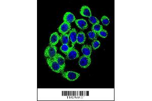 Image no. 2 for anti-Ataxin 1 (ATXN1) (AA 754-781) antibody (ABIN389309)