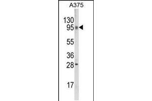 Image no. 1 for anti-Chromosome 6 Open Reading Frame 170 (C6ORF170) (AA 112-139), (N-Term) antibody (ABIN5539193)