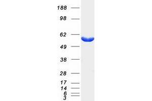 Image no. 1 for 6-phosphofructo-2-Kinase/fructose-2,6-Biphosphatase 4 (PFKFB4) protein (Myc-DYKDDDDK Tag) (ABIN2728751)