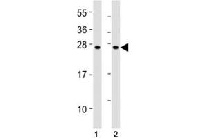 Image no. 6 for anti-Suppressor of Cytokine Signaling 1 (SOCS1) (AA 35-66) antibody (ABIN3029042)