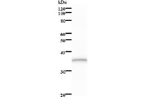Image no. 1 for anti-TAF5-Like RNA Polymerase II, P300/CBP-Associated Factor (PCAF)-Associated Factor, 65kDa (TAF5L) antibody (ABIN932215)