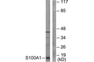 Image no. 1 for anti-S100 Calcium Binding Protein A1 (S100A1) (AA 10-59) antibody (ABIN1533394)