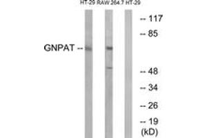 Image no. 1 for anti-Glyceronephosphate O-Acyltransferase (GNPAT) (AA 231-280) antibody (ABIN1534833)