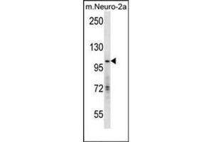 Image no. 1 for anti-K(lysine) Acetyltransferase 2A (KAT2A) (AA 806-837), (C-Term) antibody (ABIN952987)