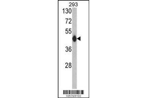 Image no. 1 for anti-Histone Acetyltransferase 1 (HAT1) (AA 389-419), (C-Term) antibody (ABIN387932)