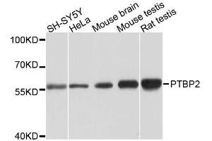 Image no. 1 for anti-Polypyrimidine Tract Binding Protein 2 (PTBP2) antibody (ABIN6146373)