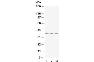Image no. 3 for anti-Guanine Nucleotide Binding Protein (G Protein), beta Polypeptide 1 (GNB1) (AA 2-42) antibody (ABIN5647367)
