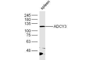 Image no. 1 for anti-Adenylate Cyclase 3 (ADCY3) (AA 651-750) antibody (ABIN5675160)
