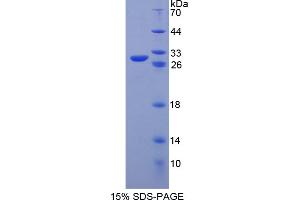 Image no. 1 for POU Class 5 Homeobox 1 (POU5F1) (AA 129-352) protein (His tag) (ABIN6236645)
