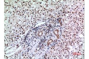 Image no. 5 for anti-B-Cell CLL/lymphoma 6 (BCL6) (Internal Region) antibody (ABIN3187827)