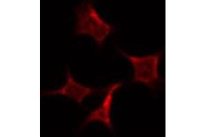Image no. 2 for anti-Protein Regulator of Cytokinesis 1 (PRC1) (Internal Region) antibody (ABIN6264405)