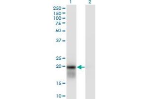 Image no. 1 for anti-Ubiquitin-Conjugating Enzyme E2H (UBE2H) (AA 1-183) antibody (ABIN563322)