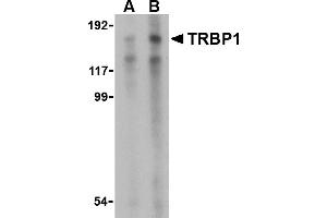 Western blot analysis of TRBP1 in 3T3 cell lysate with TRBP1 antibody at (A) 1 and (B) 2 µg/mL.