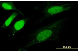 Immunofluorescence of monoclonal antibody to SNX20 on HeLa cell.