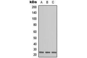Image no. 2 for anti-Ornithine Decarboxylase Antizyme 1 (OAZ1) (N-Term) antibody (ABIN2707668)
