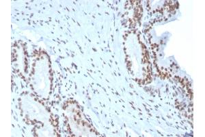 Image no. 5 for anti-BMI1 Polycomb Ring Finger Oncogene (BMI1) (AA 142-326) antibody (ABIN6940582)