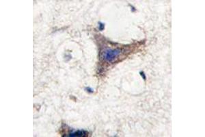 Image no. 2 for anti-Sprouty-Related, EVH1 Domain Containing 1 (SPRED1) (C-Term) antibody (ABIN356945)