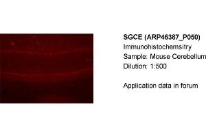 Image no. 4 for anti-Sarcoglycan, epsilon (SGCE) (N-Term) antibody (ABIN2782610)