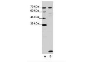 Image no. 3 for anti-LSM2 Homolog, U6 Small Nuclear RNA Associated (LSM2) (C-Term) antibody (ABIN202014)