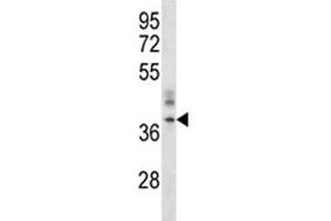 Image no. 2 for anti-ORAI Calcium Release-Activated Calcium Modulator 1 (ORAI1) (AA 269-298) antibody (ABIN3028903)
