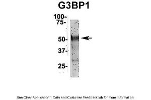 Image no. 2 for anti-GTPase Activating Protein (SH3 Domain) Binding Protein 1 (G3BP1) (N-Term) antibody (ABIN2780222)