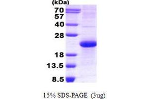 Image no. 1 for Neuroblastoma 1, DAN Family BMP Antagonist (NBL1) protein (His tag) (ABIN1098541)