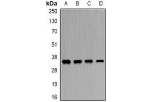Image no. 2 for anti-Origin Recognition Complex, Subunit 6 (ORC6) (full length) antibody (ABIN6005882)
