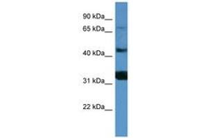 Image no. 1 for anti-Antigen P97 (Melanoma Associated) Identified By Monoclonal Antibodies 133.2 and 96.5 (MFI2) (AA 518-567) antibody (ABIN6746807)