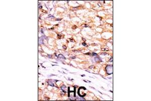 Immunohistochemistry (IHC) image for anti-CTD (Carboxy-terminal Domain, RNA Polymerase II, Polypeptide A) Small Phosphatase 1 (CTDSP1) antibody (ABIN2158391)