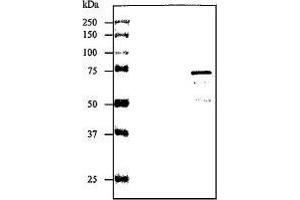 Image no. 2 for anti-Streptolysin O (SLO) (full length) antibody (ABIN2452132)
