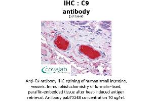 Image no. 1 for anti-Complement Component C9 (C9) (AA 184-411) antibody (ABIN1732510)