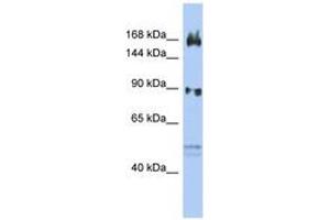 Image no. 1 for anti-AF4/FMR2 Family, Member 2 (AFF2) (N-Term) antibody (ABIN6742451)