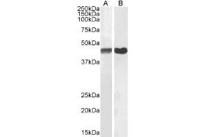 Image no. 6 for anti-Actin, alpha 2, Smooth Muscle, Aorta (ACTA2) (N-Term) antibody (ABIN185271)