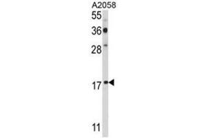 Image no. 1 for anti-P53 and DNA-Damage Regulated 1 (PDRG1) (N-Term) antibody (ABIN453261)