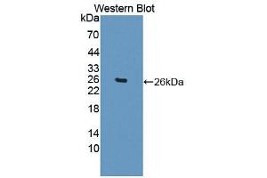 Image no. 2 for anti-Lectin, Galactoside-Binding, Soluble, 12 (LGALS12) (AA 119-311) antibody (ABIN5013589)