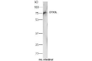 DTX3L Antikörper  (AA 651-740)