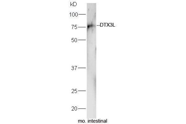 DTX3L Antikörper  (AA 651-740)