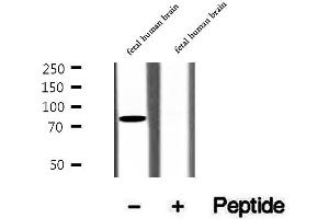 SH3KBP1 Antikörper  (N-Term)