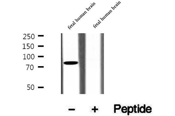 anti-SH3-Domain Kinase Binding Protein 1 (SH3KBP1) (N-Term) antibody