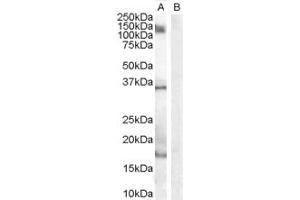 Image no. 5 for anti-Allograft Inflammatory Factor 1 (AIF1) (Internal Region) antibody (ABIN185597)