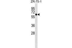 Image no. 1 for anti-Arylsulfatase D (ARSD) (AA 501-532), (C-Term) antibody (ABIN950526)